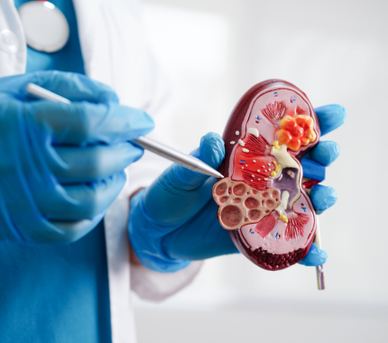 Uro Oncology